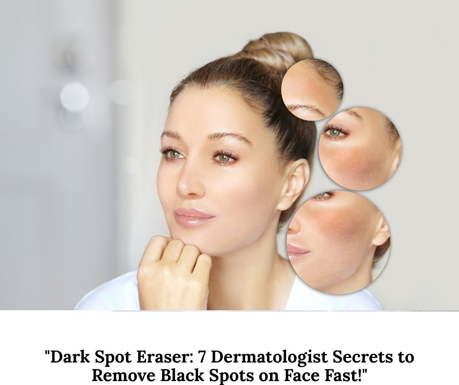 Remove Dark Spots Naturally
