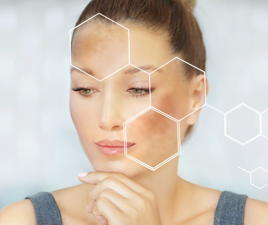 Preventing Dark Spots